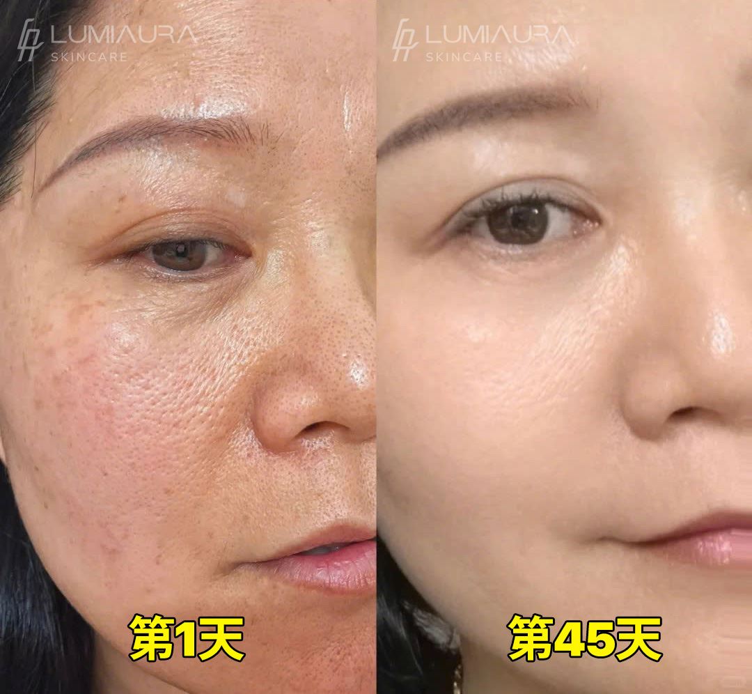 Before & After