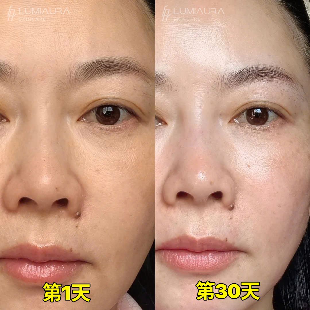 Before & After