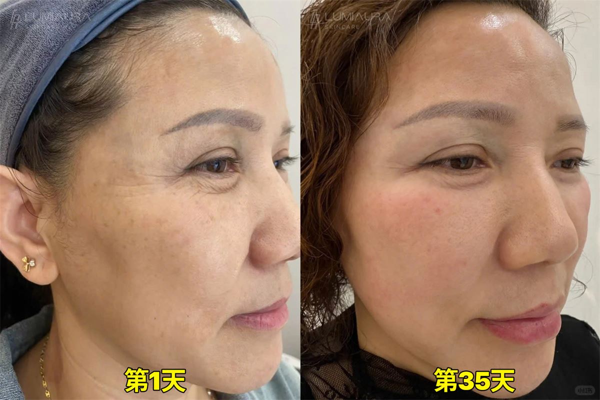 Before & After