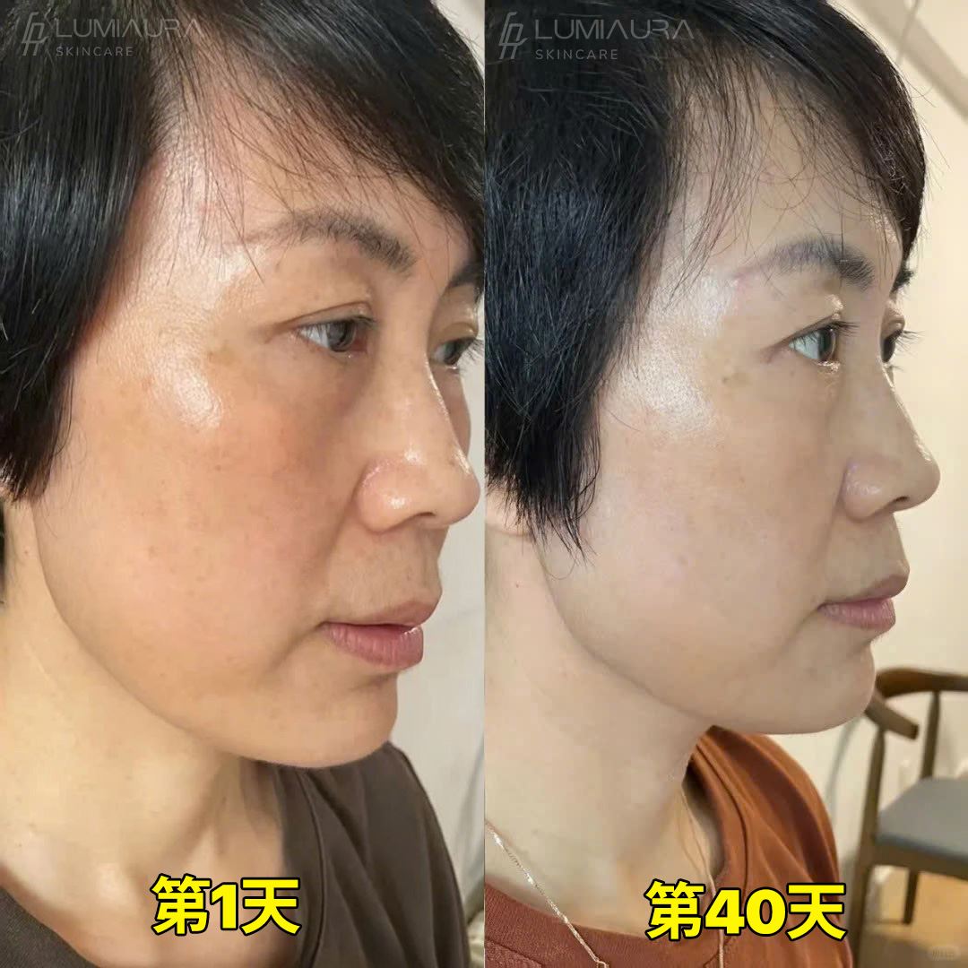 Before & After