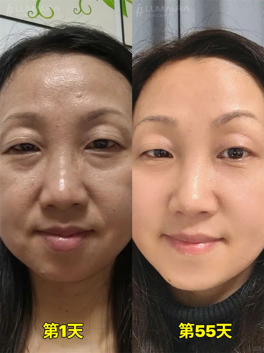Before & After